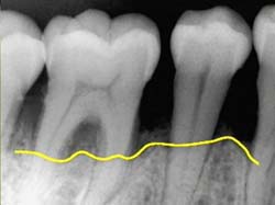 Salut oral és salut general | Centre Dental Cise