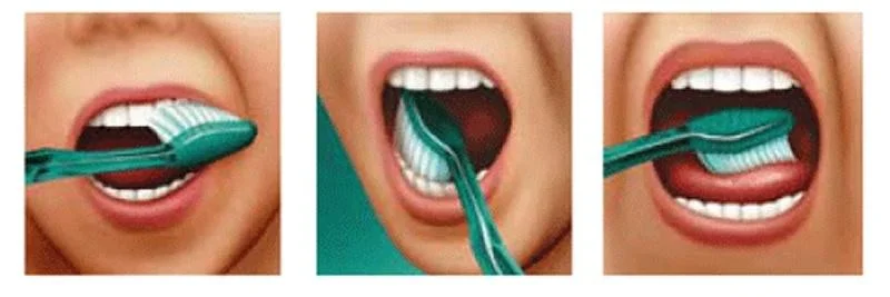 Técnica correcta cepillado de dientes Técnica correcta cepillado de dientes | Centre Dental Cise