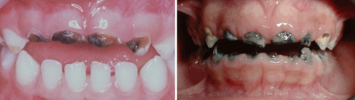 Us del Biberó | Centre Dental Cise