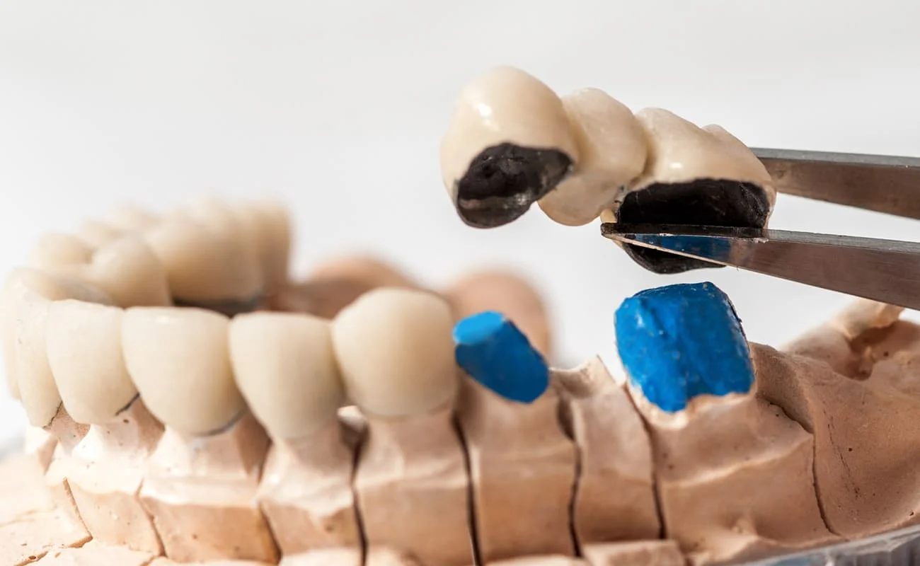 Centre Dental Cise - Laboratori dental