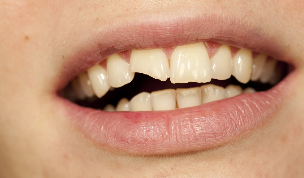 Urgencias Dentales en Borrassà