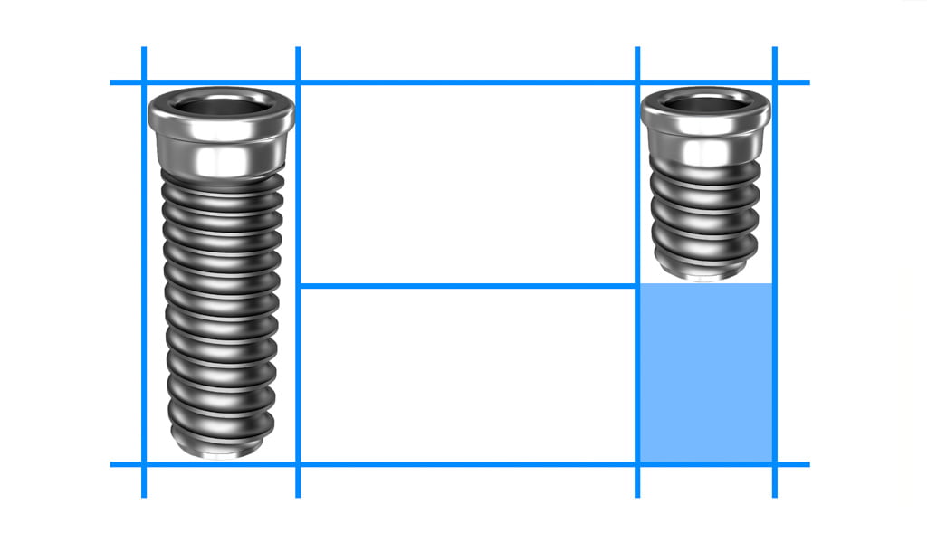 implantes dentales en Figueres