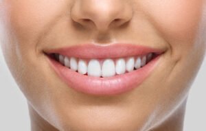 Estética dental a Figueres