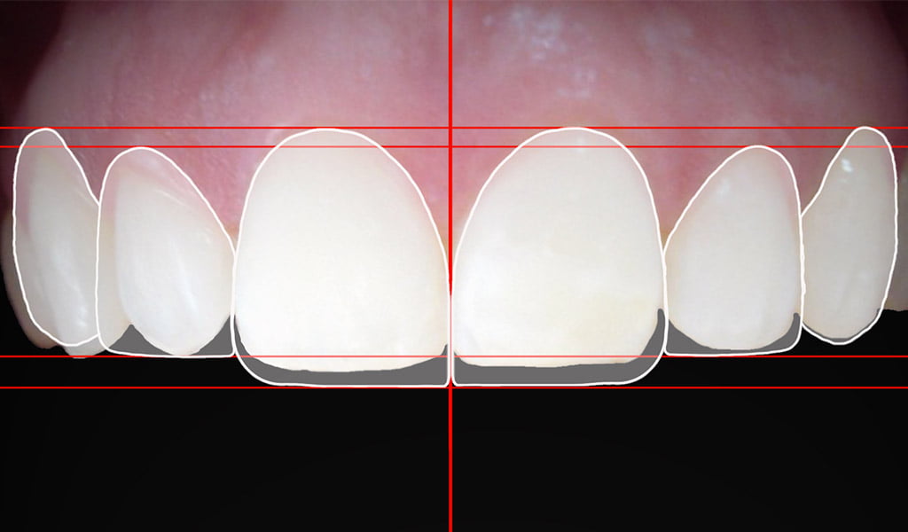 Estética dental a Figueres