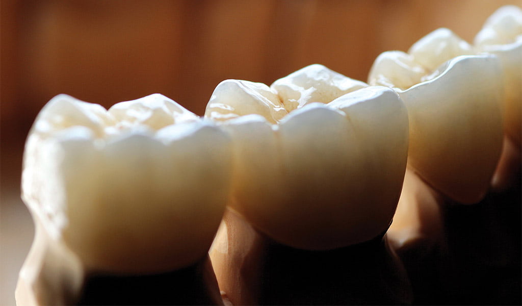 Estética dental a Figueres
